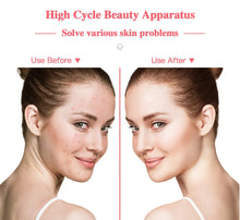 Load image into Gallery viewer, Electrode Skin Care Wand